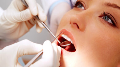 Dental Repair